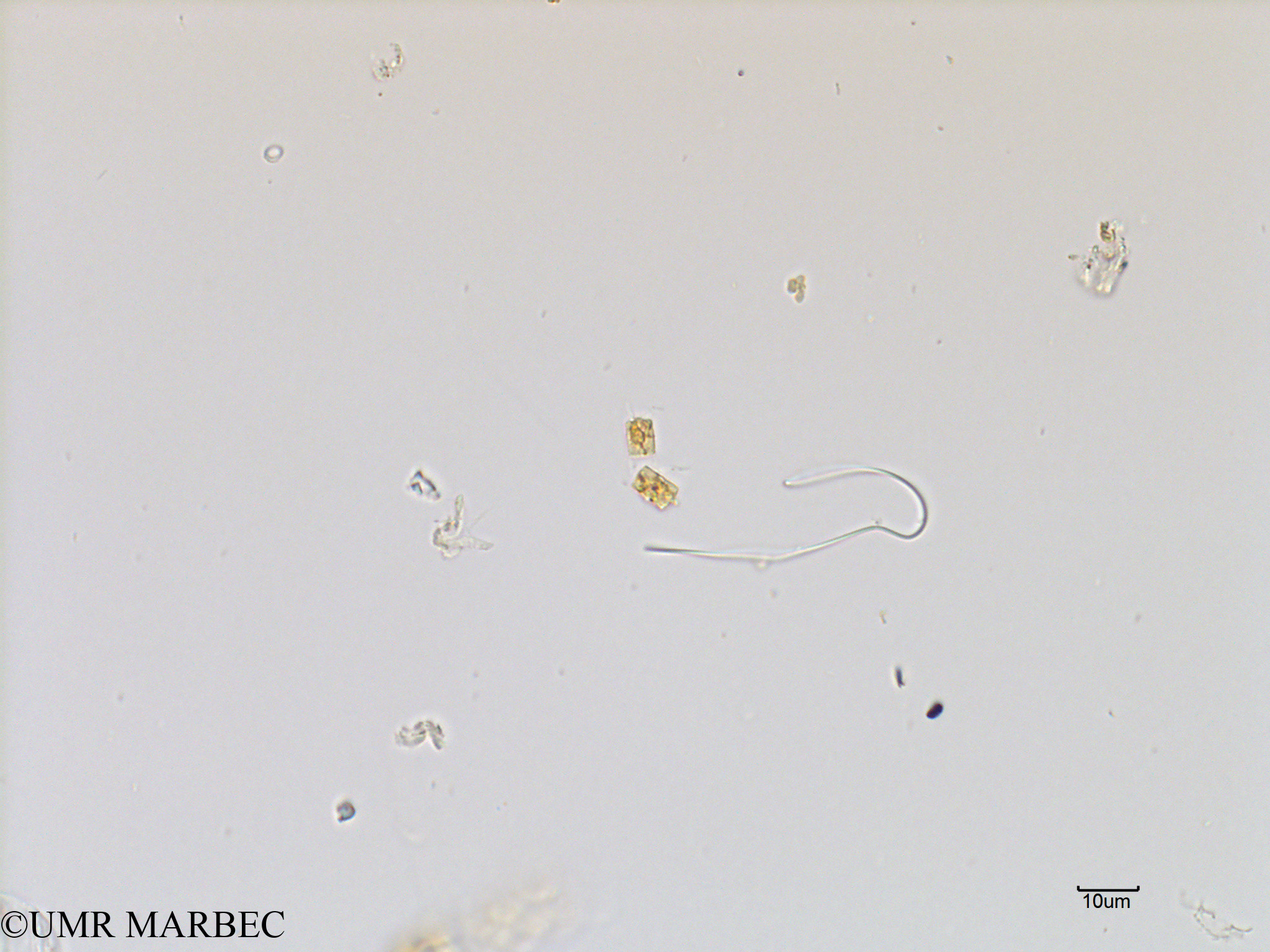 phyto/Scattered_Islands/mayotte_lagoon/SIREME May 2016/Chaetoceros sp22 (MAY3_petite centrique cf chaetoceros).tif(copy).jpg